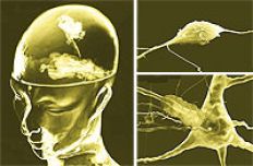 /fotos/futuro/20041113/notas_f/cerebro.jpg